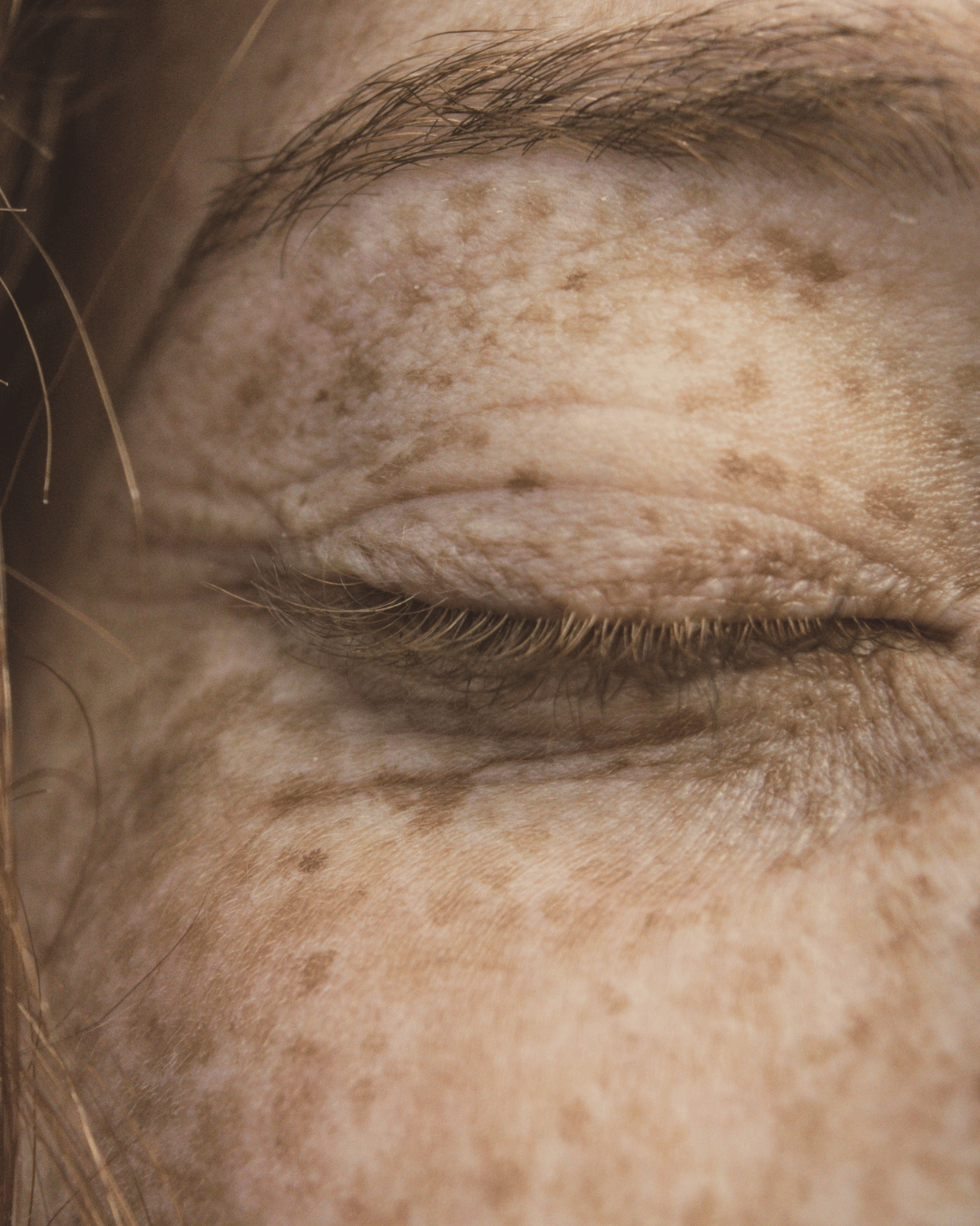 Como a pele reflete o nosso interior? - KOTE skincare