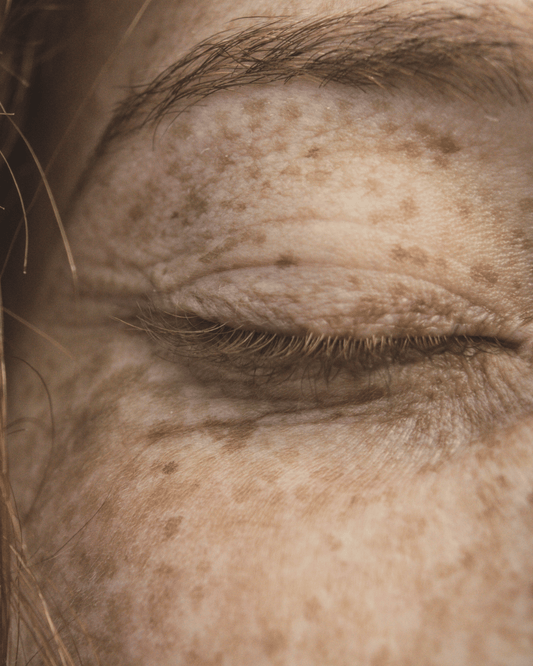 Como a pele reflete o nosso interior? - KOTE skincare